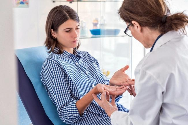 Eczema